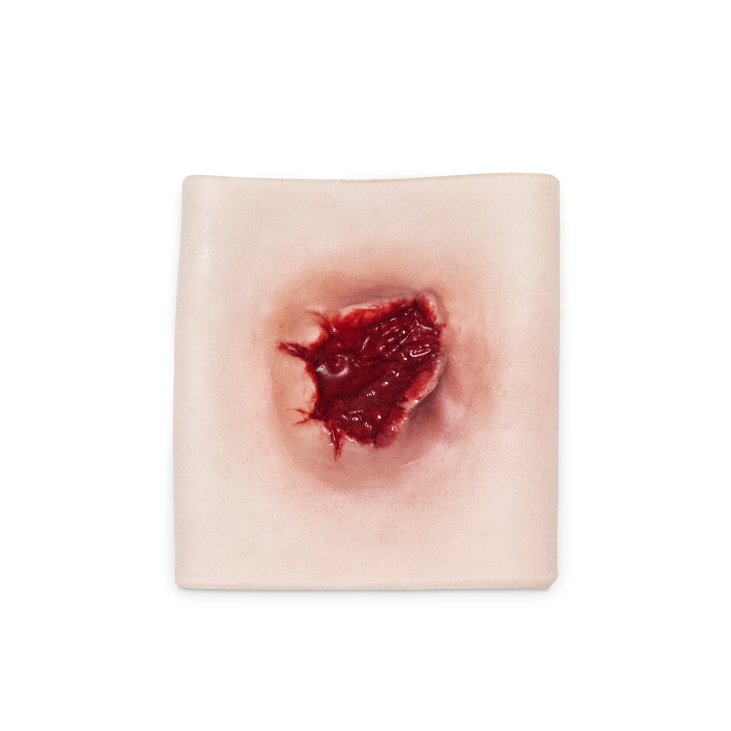 Gunshot wound with entrance and exit