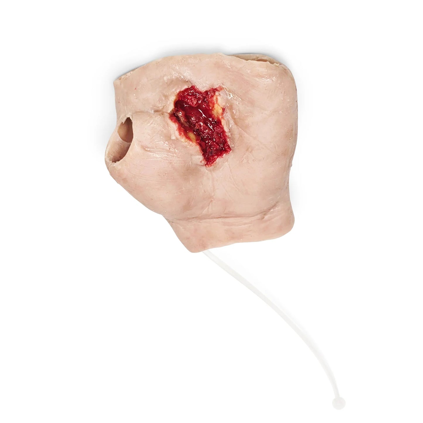 Perforated gunshot wound left hand with blood supply