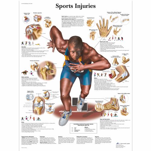 Anatomisk planche: Sportsskader, papir