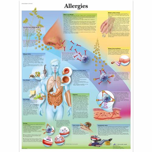 Anatomisk planche: Allergier, lamineret