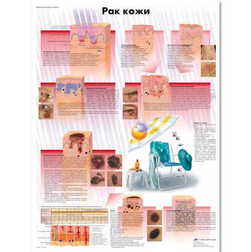 Anatomisk planche: Hudkræft, lamineret med metaløjer