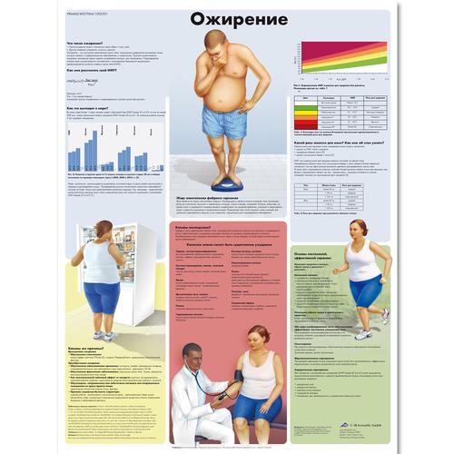 Anatomisk planche: Overvægt (adipositas), lamineret med metaløjer