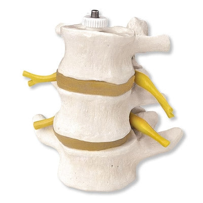 Lumbar vertebrae 3 parts