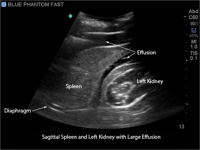 Blue Phantom ultraljudsträningsmodell snabb undersökning i realtid