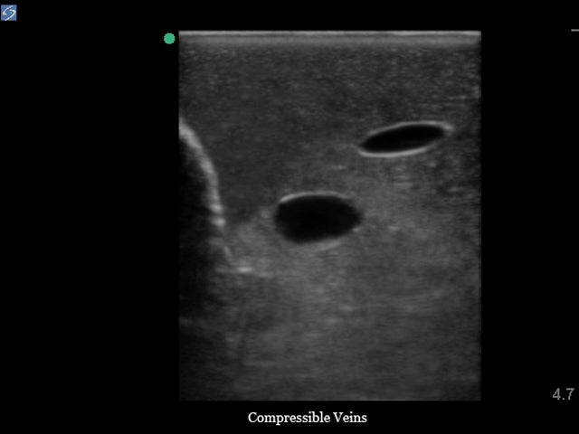 Blue Phantom Ultrasound Training Model Central Line and Regional Anesthesia