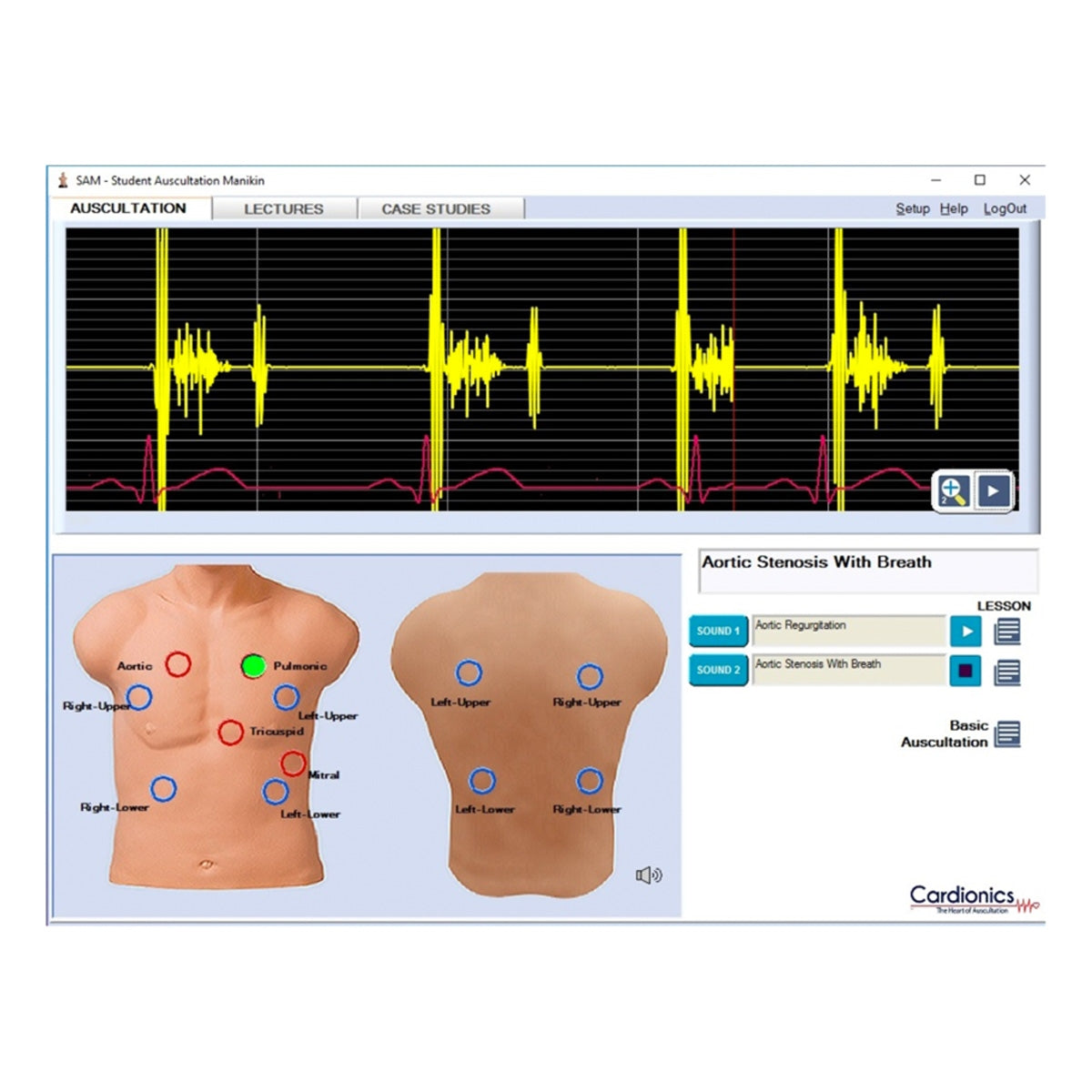 SAM 3G - Student Auskultation Manikin 3. Generation