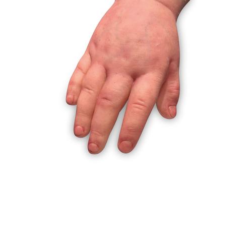 Lifecast Barn med Downs Syndrom (Gwen)