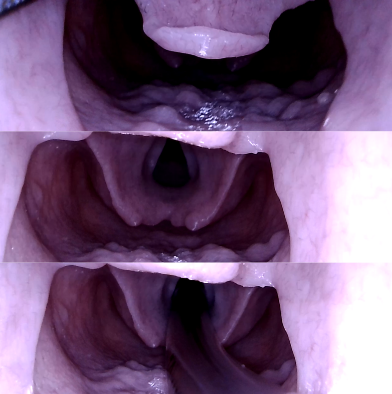 Airway Management Trainer V2 Decent