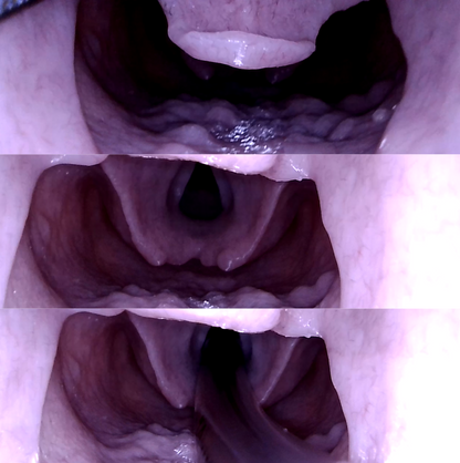 Airway Management Trainer V2 Decent