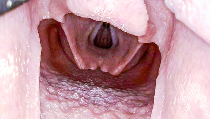 Airway Management Trainer V2 Decent