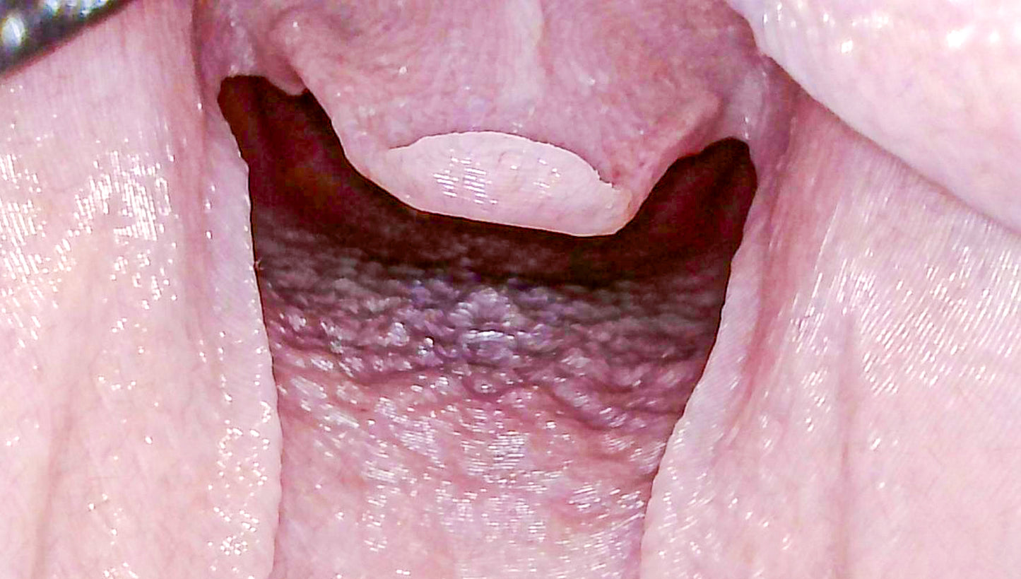 Airway Management Trainer V2 Decent