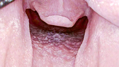 Airway Management Trainer V2 Decent
