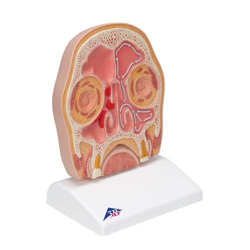 Frontalsnit af hovedet (bihuler) – billede 2