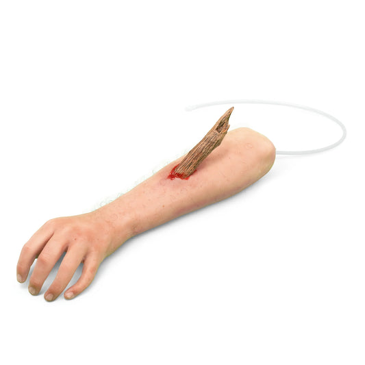 Arm with foreign body - Bleeding