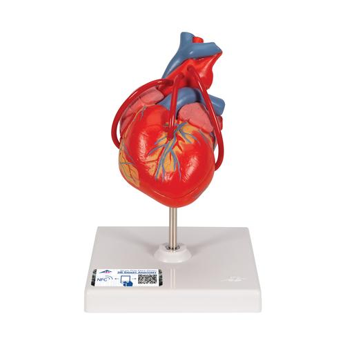 Hjertemodel Classic med bypass, 2 dele