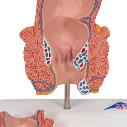 Hæmoridemodel – billede 8
