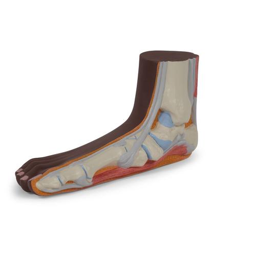 Fodmodel med platfod (pes planus), mørk hudtone