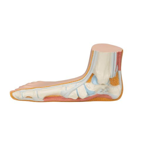 Fodmodel med platfod (pes planus) – billede 5