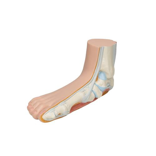 Fodmodel med platfod (pes planus) – billede 6