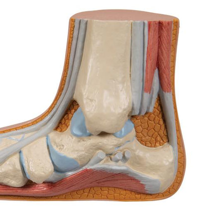 Fodmodel med platfod (pes planus) – billede 7