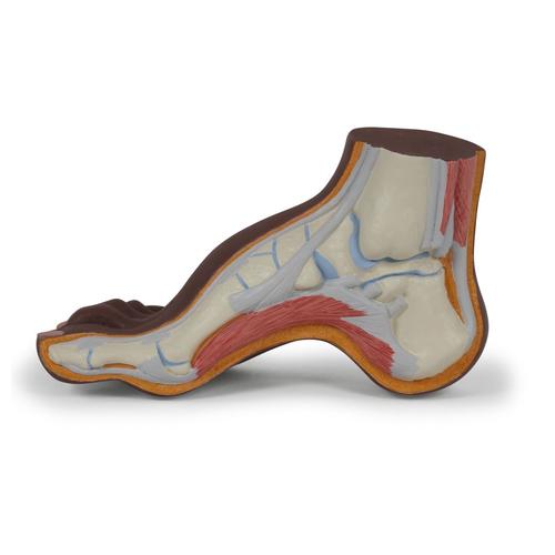 Fodmodel med hulfod (pes cavus), mørk hudtone