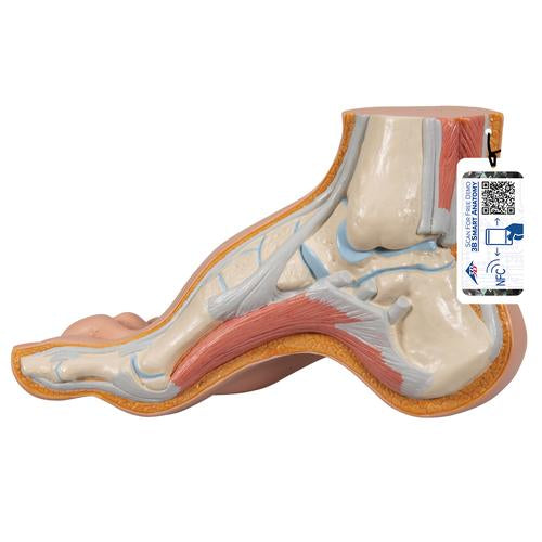 Fodmodel med hulfod (pes cavus)