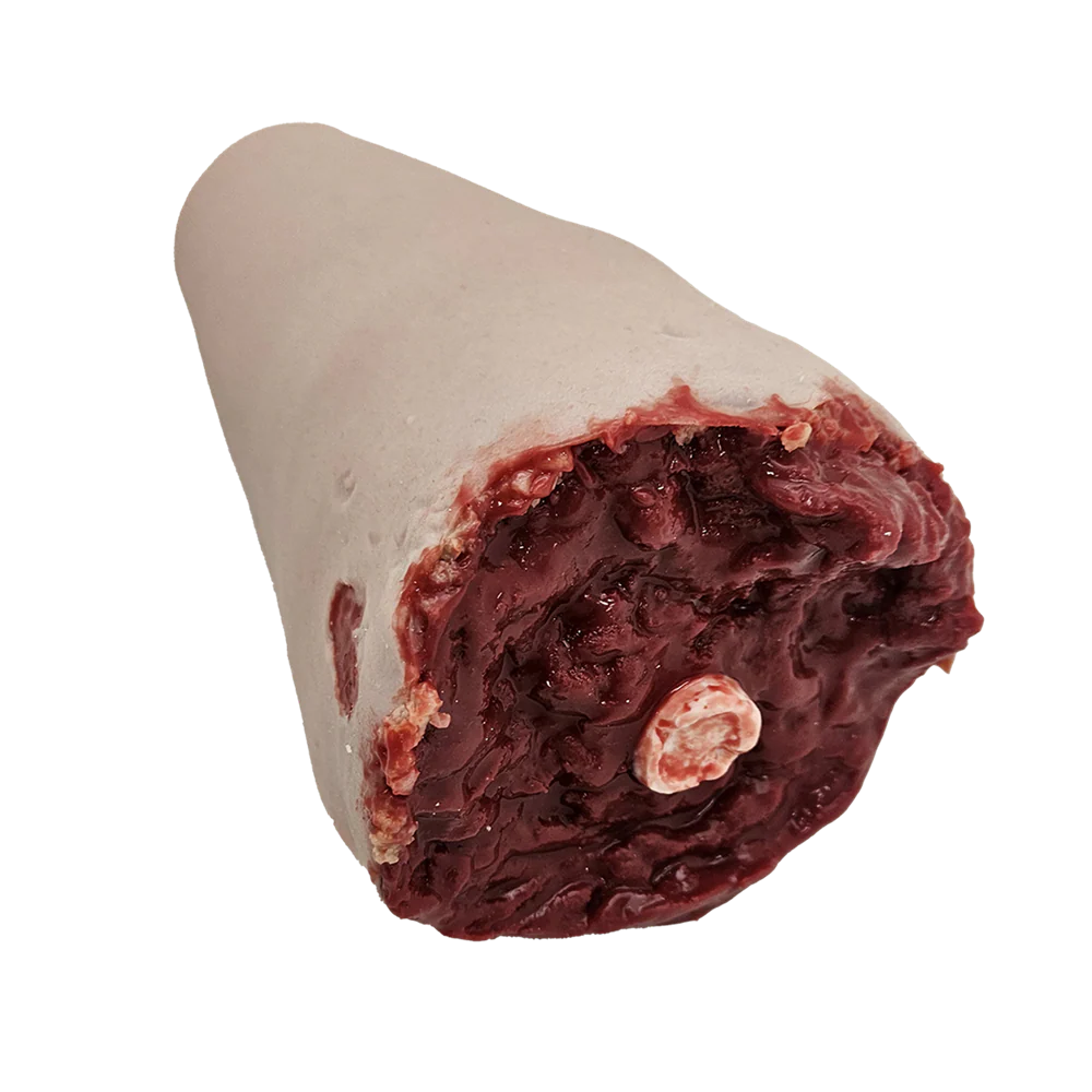 Amputation av benstump