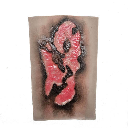 Large Burn Wound 