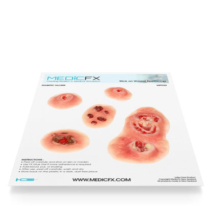 Sheet with wound - Diabetic