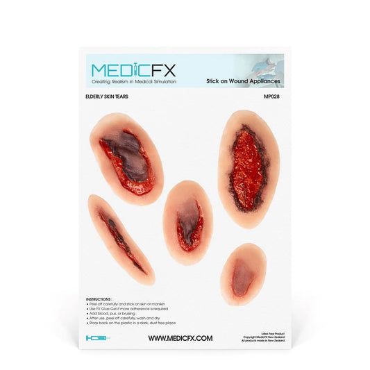Elderly Skin Tear