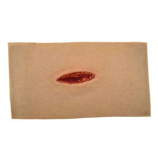 Lille Laceration