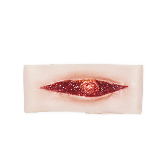 Wide Wound w. Exposed Trachea