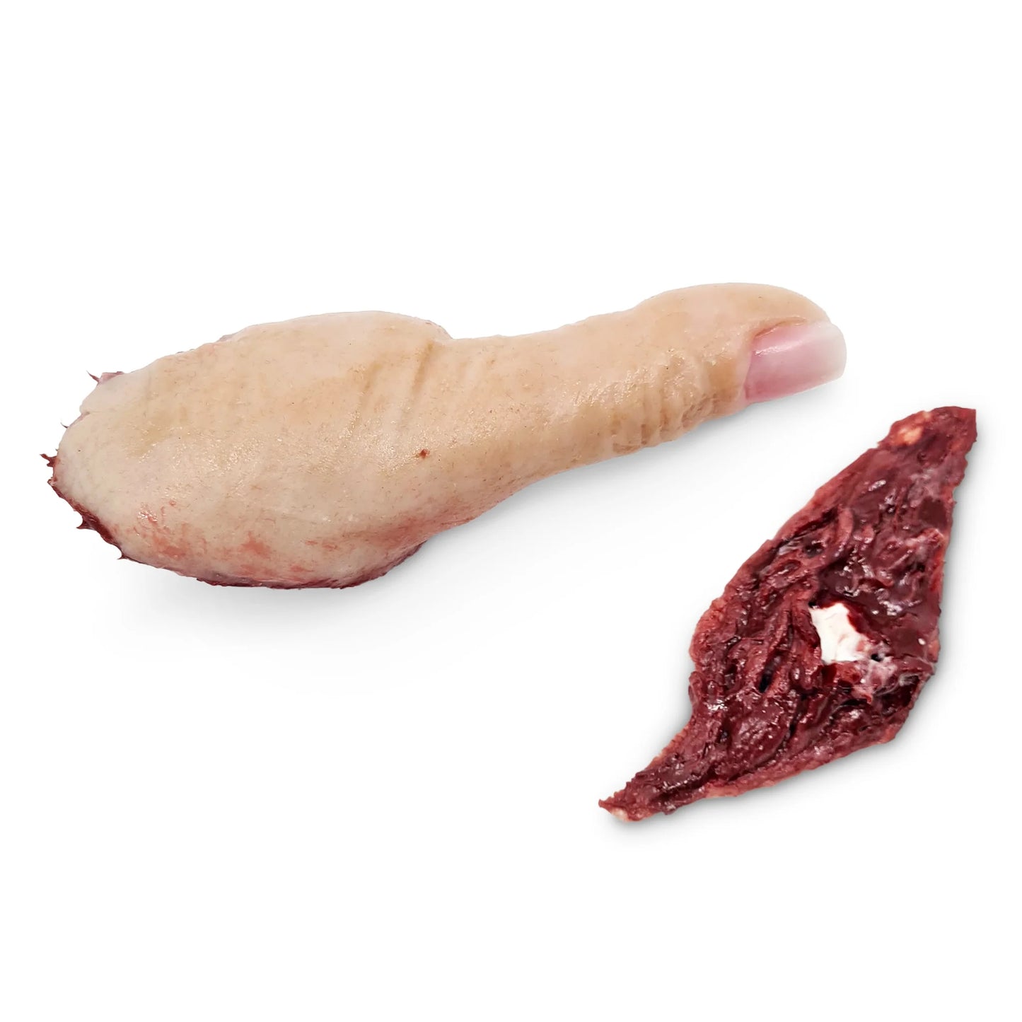 Afskåret Tommelfinger m. Fastgørelse
