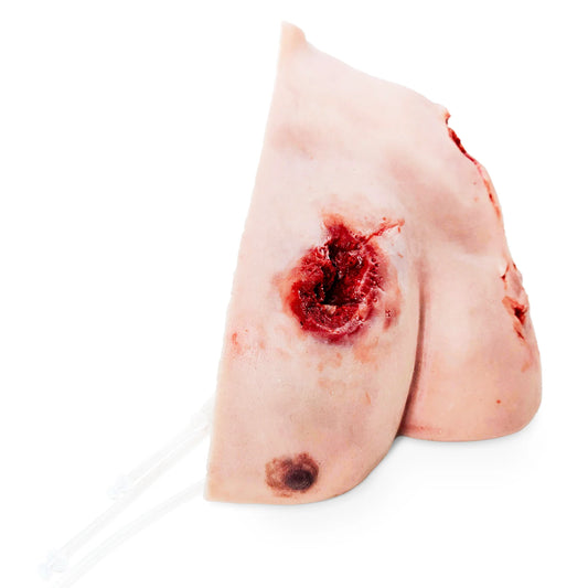 Shoulder for Wound Dressing - MedicFX
