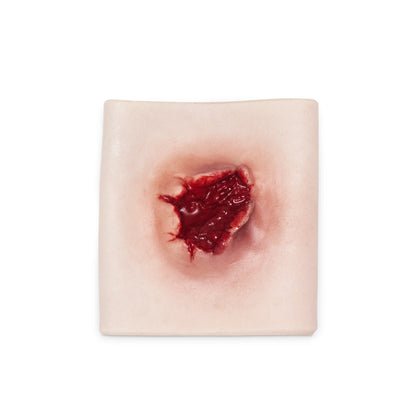 Gunshot wound with entrance and exit