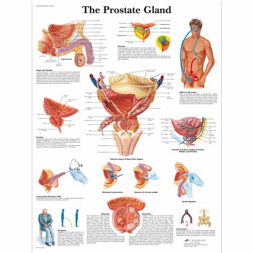 Anatomisk planche: Prostata, lamineret
