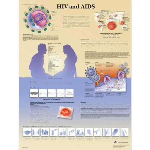 Anatomisk planche: Hiv og aids, lamineret