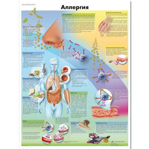 Anatomisk planche: Allergier, lamineret med metaløjer