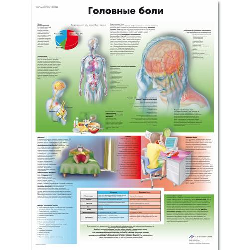 Anatomisk planche: Hovedpine, lamineret med metaløjer