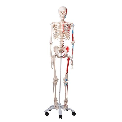Max Skeleton