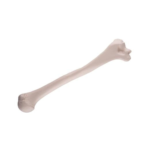 Humerus Overarmsknogle