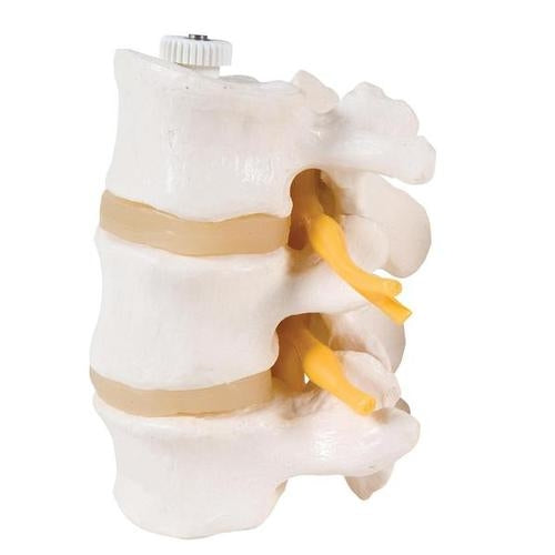 Lumbar vertebrae 3 parts