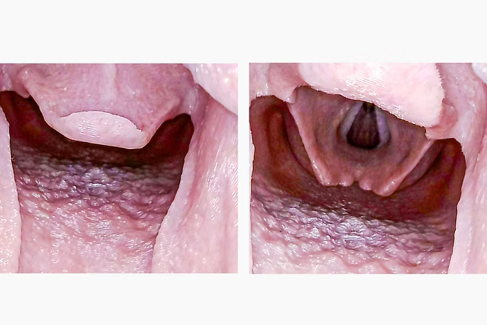 Airway Management Trainer V2 Decent