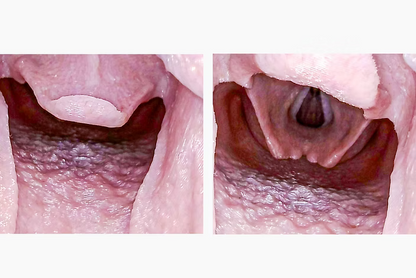 Airway Management Trainer V2 Decent