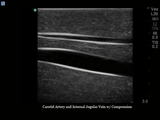 Blue Phantom Ultrasound Training Model Central Line and Regional Anesthesia