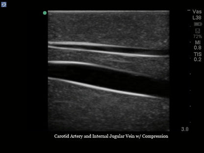 Blue Phantom Ultrasound Training Model Central Line and Regional Anesthesia