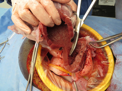 C-Celia - simulator for handling emergency hysterectomy after cesarean section