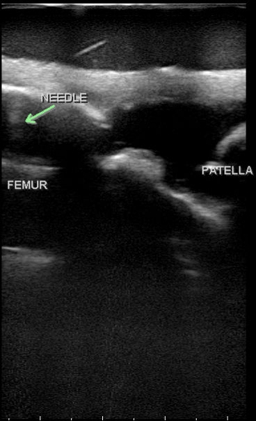 Muskuloskeletal ultralydstræningsmodel BluePhantom