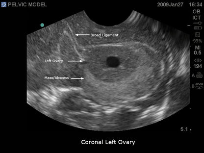 BluePhantom transvaginal ultraljudsträningsmodell för generell patologi