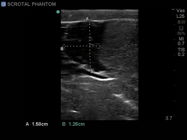 Blue Phantom ultraljudsträningsmodell för skrotal ultraljud